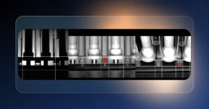 Automatic Syringe Inspection Defects